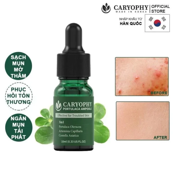 Serum Mụn Caryophy Portulaca Ampoule - Tinh chất giảm mụn và mờ thâm 30ml - Ảnh 6